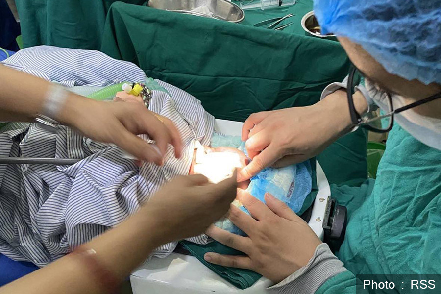 २९ हप्तामा जन्मेको शिशुको ‘लेन्स स्पेयरिङ भिट्रेक्टोमी’ सफल